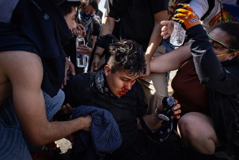 Jason Armond/Los Angeles Times/TNS