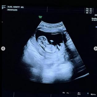 Bang Showbiz / Elsie Hewitt is pregnant (c) Instagram