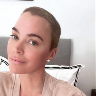 Bang Showbiz / Teddi Mellencamp has admitted trolls' comment about her hair loss have hurt.