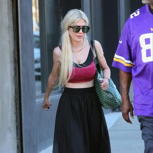 Bang Showbiz / Tori Spelling claimed her dog chewed a human toe