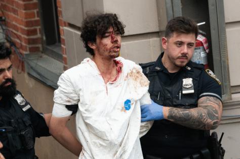 Gardiner Anderson/New York Daily News/TNS