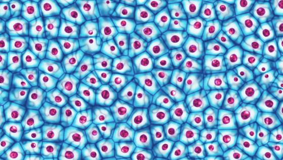 Eduard Muzhevskyi/Dreamstime/TNS