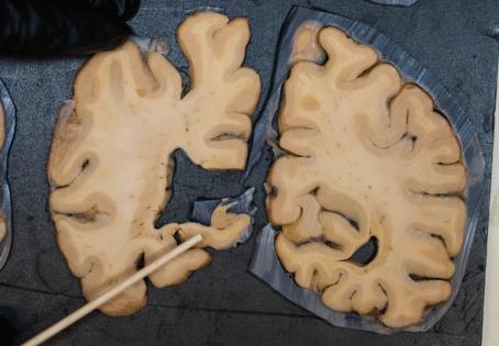 Dean Rutz/Seattle Times/TNS