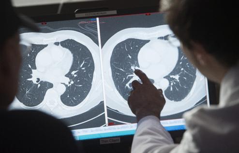 Saul Loeb/Getty Images North America/TNS