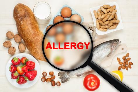 Navigating food allergies can feel very stressful. (Dreamstime/TCA)