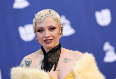 Arturo Holmes/Getty Images North America/TNS