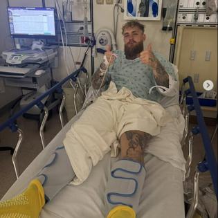 Bang Showbiz / Jake Paul has undergone surgery