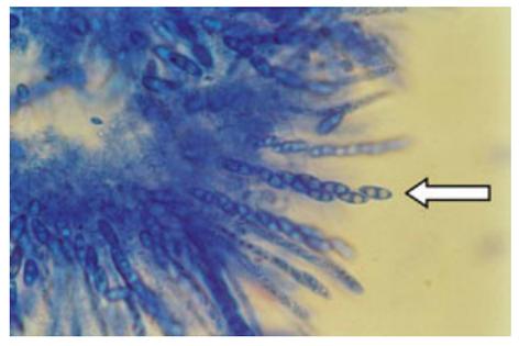 Gibberella (Fusarium) xylarioides, with arrow pointing to its spore-containing sac.
              Julie Flood