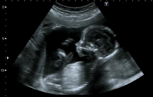 Giovanni Gagliardi/Dreamstime/TNS