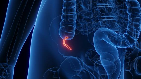 Most people get acquainted with their appendix when it's inflamed and about to rupture. Sebastian Kaulitzki/Science Photo Library via Getty Images