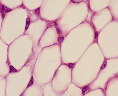 White adipose cells provide several essential bodily functions.
              Ed Reschke/Stone via Getty Images