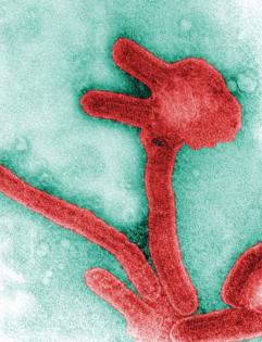 Frederick Murphy/CDC/TNS/TNS