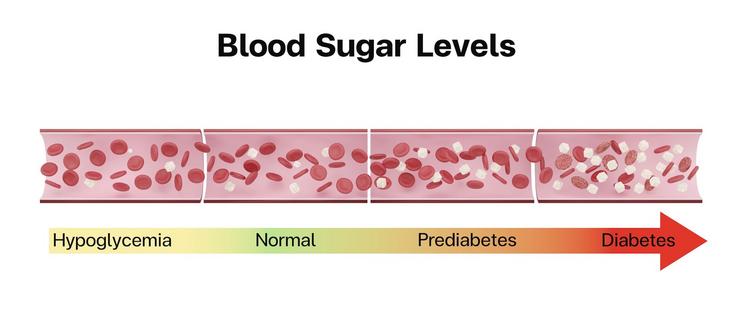 A healthy range for glucose levels is between 70 and 120 milligrams per deciliter. For people with diabetes, glucose levels generally run high.
              piyaset/iStock via Getty Images Plus