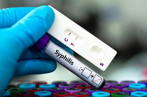 A cascade of factors during the COVID-19 pandemic limited screening and treatment services.
              Kitsawet Saethao/iStock via Getty Images Plus