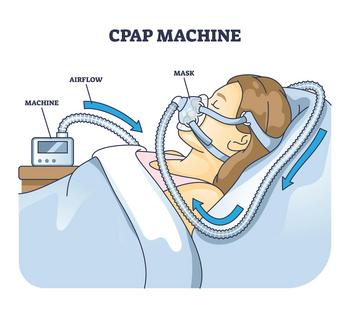 CPAP is the most common treatment for sleep apnea, but many people find it intolerable.
              VectorMine/iStock via Getty Images