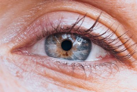 The outer layer of the eyelid, called the epidermis, is highly sensitive to environmental allergens and other irritants.
Francesco Riccardo Iacomino/Moment via Getty Images