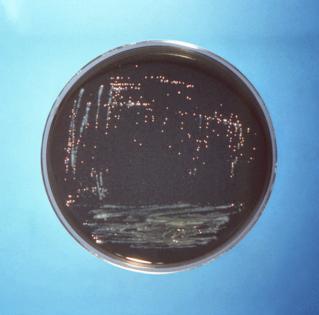 Centers for Disease Control and Prevention/TNS