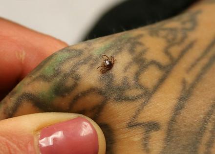 How a tick feeds.
              National Institute of Allergy and Infectious Diseases via Wikimedia Commons, CC BY