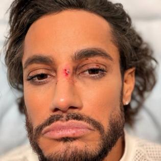 Bang Showbiz / Frankie Grande got hurt on Broadway