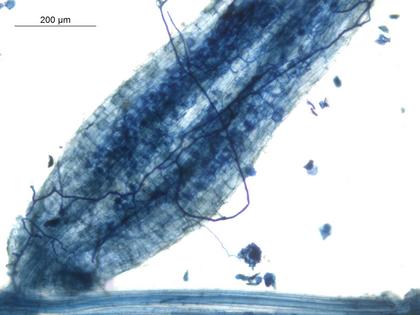 A microscope image using dye shows microbe filaments, known as hyphae, around a plant root, and arbuscular mycorrhizae fungi inside the root.
              Rajarshi Rit/The University of Burdwan, CC BY