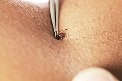 You don't want a lone star tick, or any tick, to get to this point if you can help it. CDC via Smith Collection/Gado/Getty Images