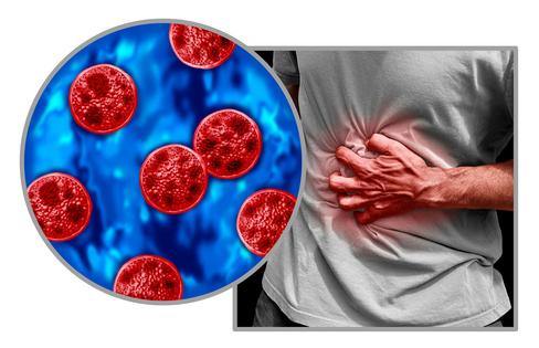 Cyclosporiasis can cause severe gastrointestinal distress, including explosive diarrhea. wildpixel/iStock via Getty Images Plus