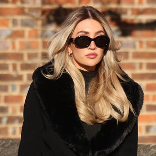 Bang Showbiz / Kate Cassidy has had her tattoo removed