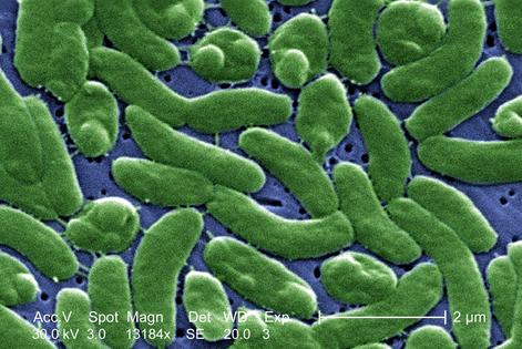 _Vibrio vulnificus_ infections are spreading across the U.S. because of climate change CDC/Colorized by James Gathany