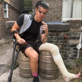 Bang Showbiz / Yungblud is in a cast after breaking his leg in a motorcycle accident
