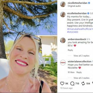 Bang Showbiz / Nicollette Sheridan suffers 'third-degree rope burns' after 'ugly and painful' dog incident