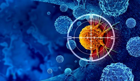 Pancreatic cancer has been notoriously difficult to target and treat. wildpixel/iStock via Getty Images Plus