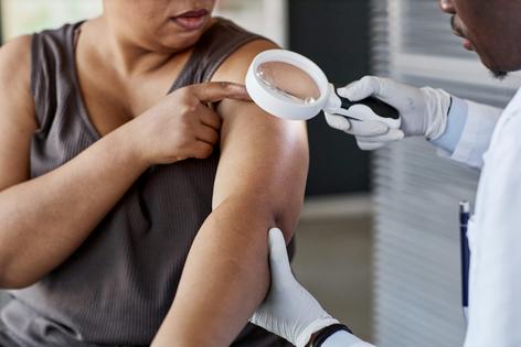 Melanoma and other skin conditions can look different in people with darker versus lighter skin – but image databases include many more examples from people with lighter skin.  SeventyFour/iStock via Getty Images
