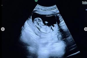 Bang Showbiz / Elsie Hewitt is pregnant (c) Instagram