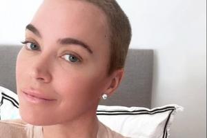 Bang Showbiz / Teddi Mellencamp has admitted trolls' comment about her hair loss have hurt.