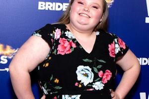 Bang Showbiz / Alana Thompson has been in a car accident