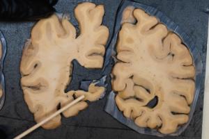 Dean Rutz/Seattle Times/TNS