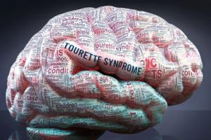 Dreamstime/Dreamstime/TNS