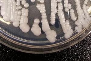 Shawn Lockhart/CDC/TNS