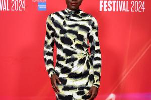 Bang Showbiz / Lupita Nyong'o has over 50 fibroids