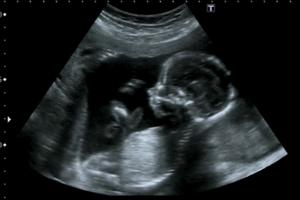 Giovanni Gagliardi/Dreamstime/TNS