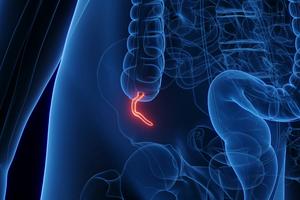 Most people get acquainted with their appendix when it's inflamed and about to rupture. Sebastian Kaulitzki/Science Photo Library via Getty Images