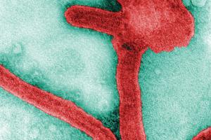 Frederick Murphy/CDC/TNS/TNS