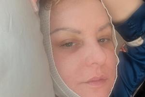 Bang Showbiz / Wendi McLendon-Covey was absent from the Bridesmaids reunion at the 98th Academy Awards as she was recovering from plastic surgery