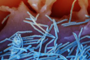 National Institute of Allergy and Infectious Diseases/National Institute of Allergy and Infectious Diseases/TNS