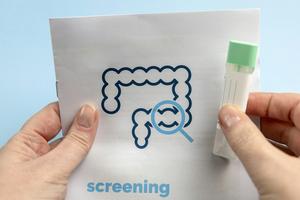 Screening is essential to prevent and effectively treat colorectal cancer. Varlay/iStock via Getty Images Plus