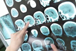 DREAMSTIME/TNS