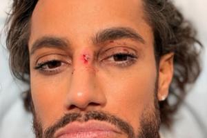 Bang Showbiz / Frankie Grande got hurt on Broadway