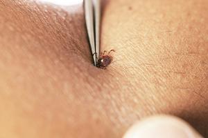 You don't want a lone star tick, or any tick, to get to this point if you can help it. CDC via Smith Collection/Gado/Getty Images