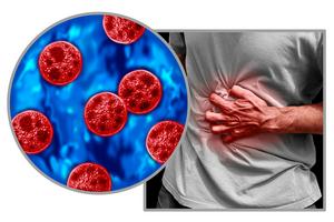 Cyclosporiasis can cause severe gastrointestinal distress, including explosive diarrhea. wildpixel/iStock via Getty Images Plus