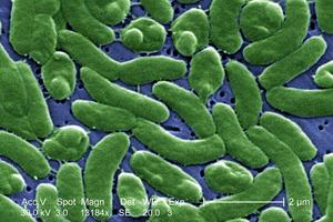 _Vibrio vulnificus_ infections are spreading across the U.S. because of climate change CDC/Colorized by James Gathany